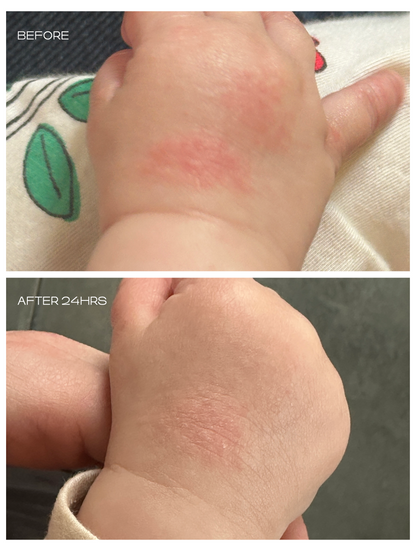 Sueet Cheeks Tallow Balm for Baby